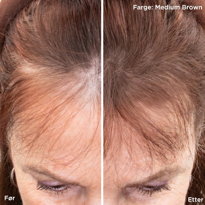 Before and after applying iGlow Hair Powder in Medium Brown at the hairline